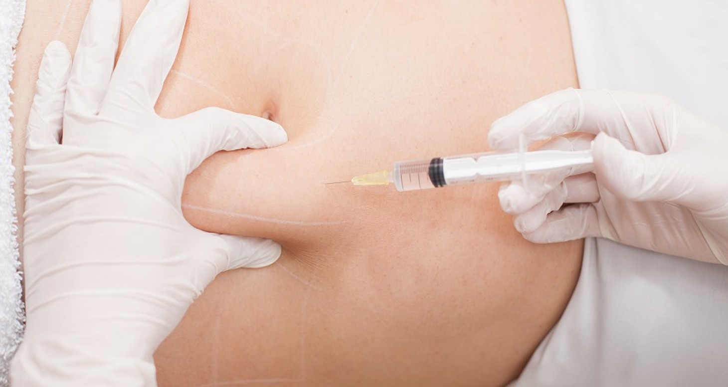 Mesotherapy injection